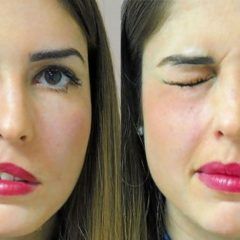 Sugiere IMSS evitar cambios bruscos de temperatura, podría ser causa de parálisis facial