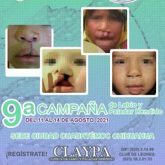DIF Municipal y Club de Leones continúan registros para 9a. campaña de labio y paladar hendido