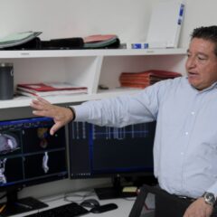 Registra Secretaría de Salud más de 82 mil sesiones de radioterapia otorgadas con acelerador lineal en la actual administración.